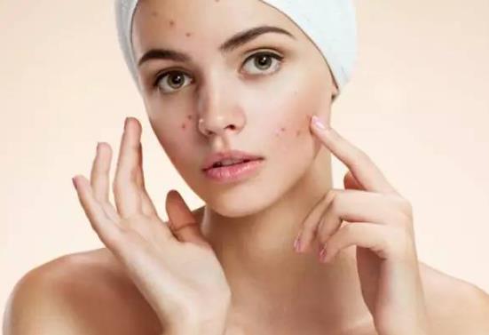 怎么去黑頭才不會擴大毛孔?怎么去鼻子上的黑頭?