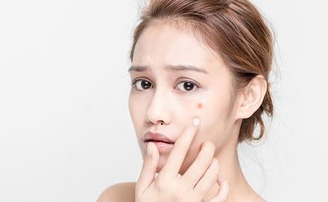 讓你快速祛痘的祛痘方法 關(guān)于痘痘你不知道的事