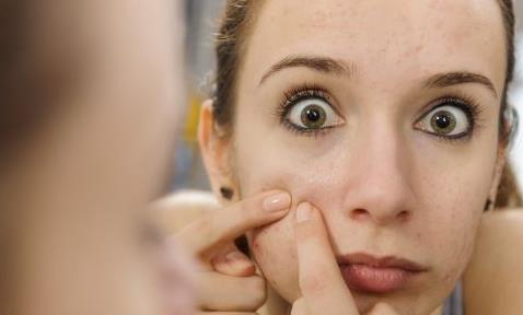 讓你快速祛痘的祛痘方法 關(guān)于痘痘你不知道的事