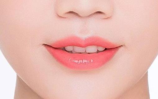 什么是豐唇術(shù) 豐唇術(shù)能維持多久 豐唇術(shù)注意事項(xiàng)