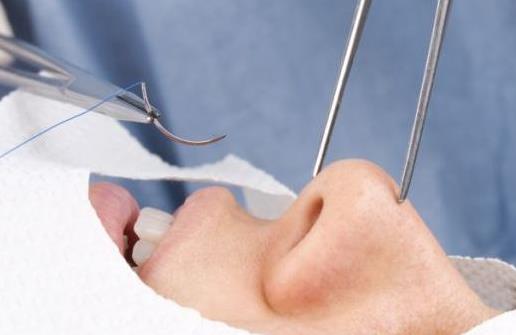 整形手術會存在什么風險 整形手術前必須注意的事項