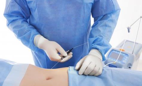 抽脂術的效果和注意事項 在決定抽脂前需要知道的幾件事