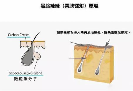 北京伊美爾紫竹醫院:光子嫩膚多久做一次