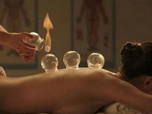 拔火罐能減肥嗎？拔火罐減肥的壞處