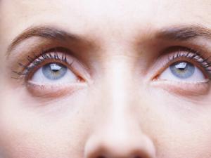 眼袋的形成原因有哪些?眼袋怎么消除