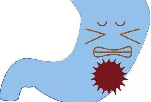 胃穿孔有哪些分類?哪些人容易患胃穿孔?