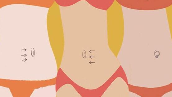 肚臍眼發炎的原因有哪些?肚臍眼的發炎藥物治療有哪些?