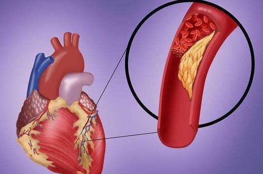 電腦族的常見疾病有哪些?電腦族怎么保護頸椎?
