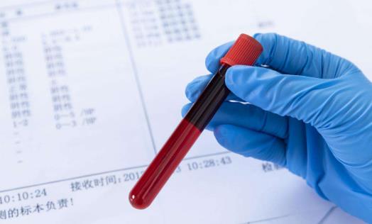 痛經可以做哪些檢查?痛經的治療方法有哪些?