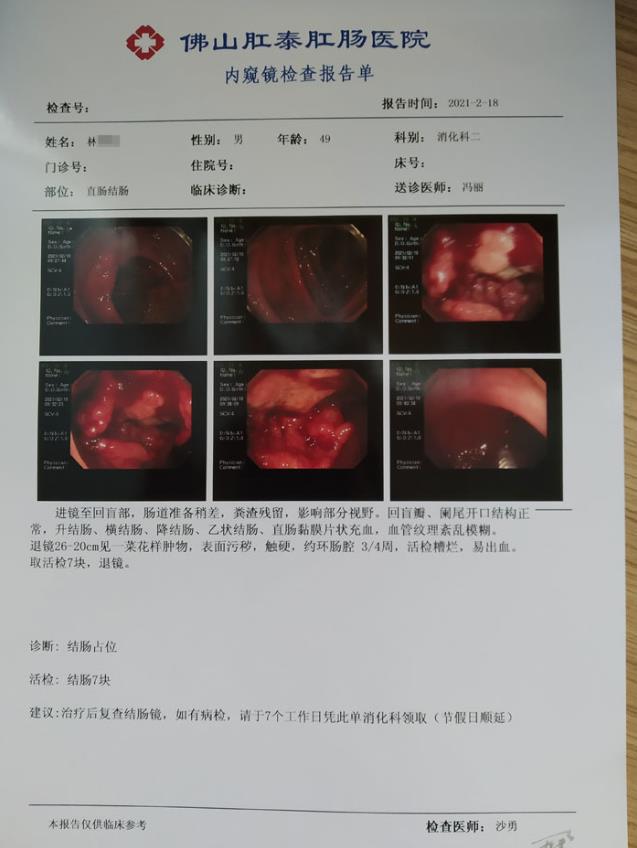 佛山肛泰是正規醫院嗎?患者們的315:講述親身就診經歷和真實評價