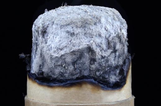 艾灸之后拉肚子是什么原因 艾灸之后拉肚子還可以灸嗎