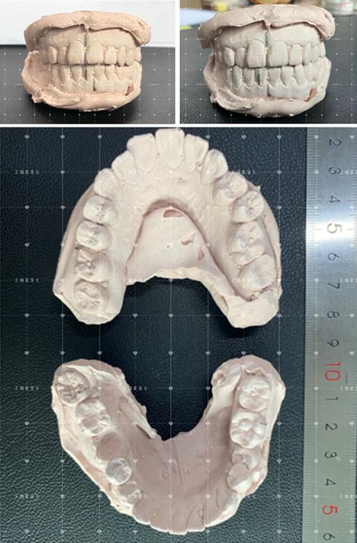 聯合麗格第一醫院柳春明教授告訴你什么是正頜手術的手術優先