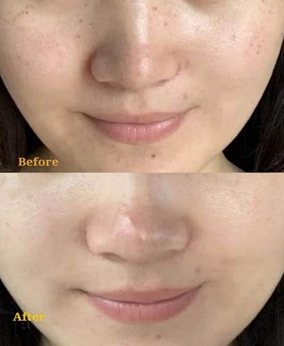 王的整形王鳳波親授光子嫩膚百搭攻略