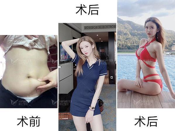 廣東韓妃整形醫(yī)院楊德發(fā)主任技術(shù)如何 定制你的天然美