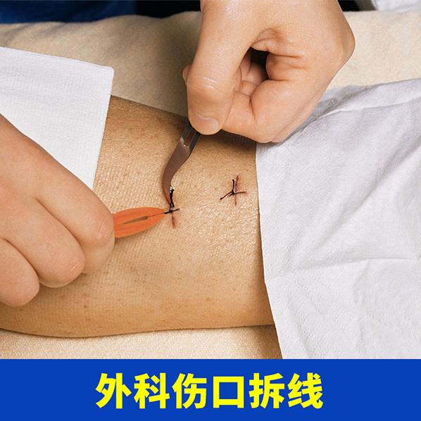 燕郊護士到家!燕達醫院“護理上門”服務項目(七)——外科傷口拆線