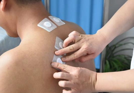 三伏貼最后一貼什么時候貼?三伏貼是隔天貼還是連續貼