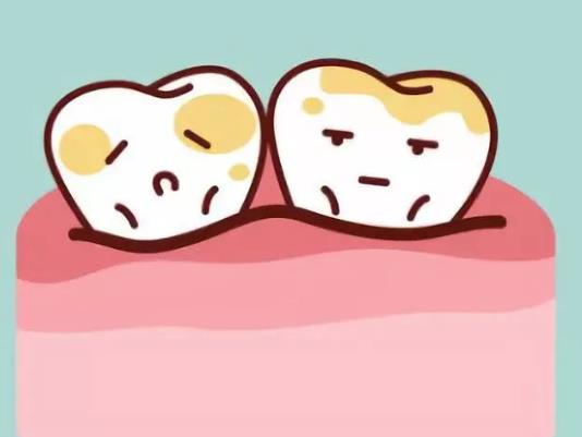 得了牙結(jié)石不想洗牙有別的方法嗎?洗了牙牙結(jié)石還會再有嗎