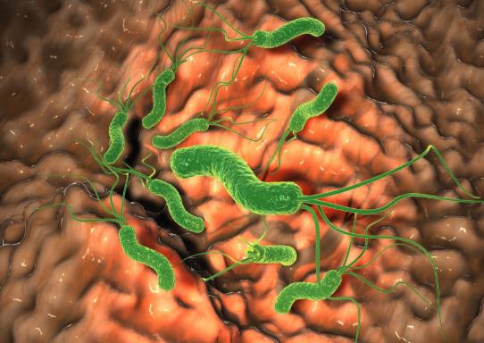 得了幽門螺桿菌怎么治療?得了幽門螺旋桿菌全家都會被傳染嗎