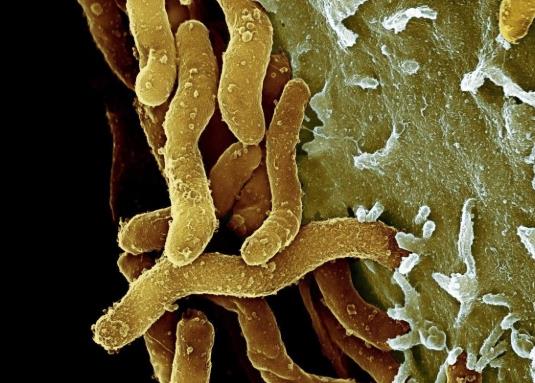 幽門螺桿菌可以自愈嗎?幽門螺桿菌會(huì)傳染嗎