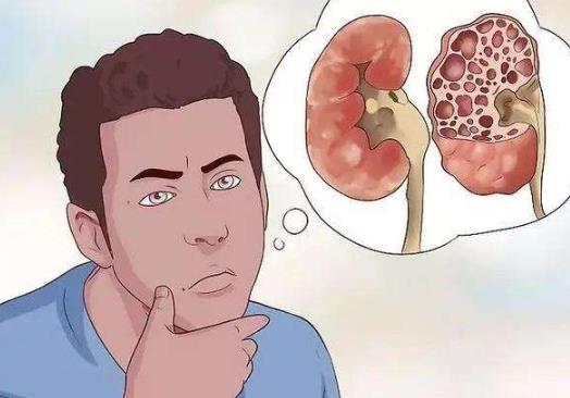 降尿酸可以喝什么茶?尿酸過高會引起什么病