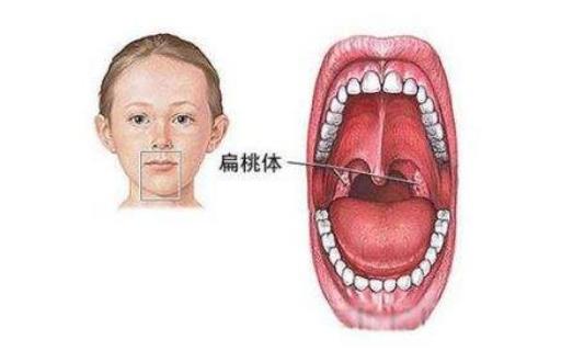 咳嗽噴出一塊石頭 石頭原來從這里來