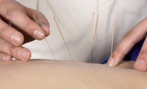 腰酸背痛的話(huà)該怎么緩解 腰酸背痛適合刮痧嗎