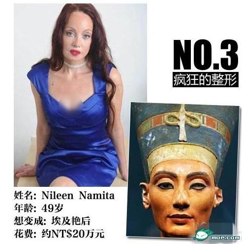 坑爹時代:那些奇葩的瘋狂變臉整容,坑爹呀