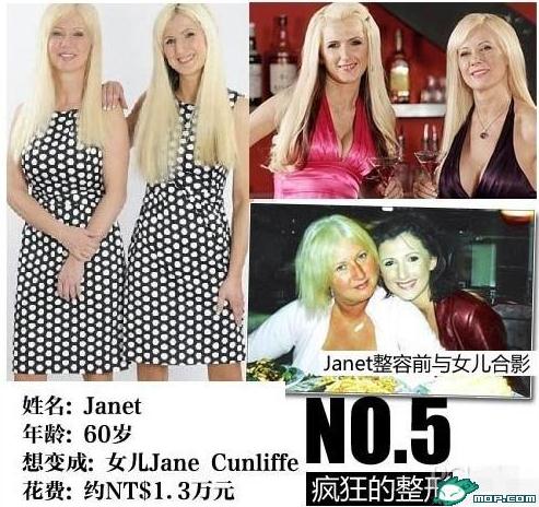 坑爹時代:那些奇葩的瘋狂變臉整容,坑爹呀