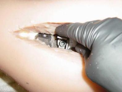 ���_������ރȲ�����Ԕ��M�D���lҪʹ�Ç��lһ��������߀�����