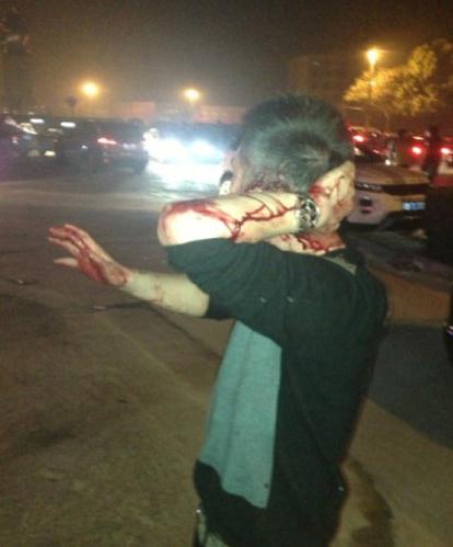 ��¶¶���d�ư��`Ҏ(gu��)��Ѩ���ǁy�ӣ�����������¶¶��Ⱥ��(�D)