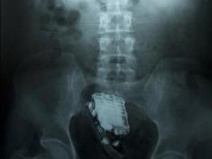 囚犯塞手機入肛門躲避獄警 卻遇友人打電話