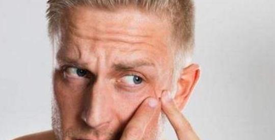 男生在青春期時長青春痘很常見 這些日常護膚要做好