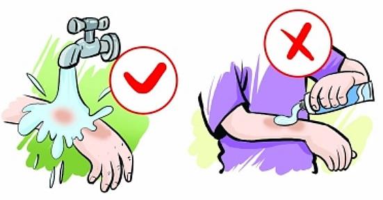 切幾片生梨,貼于燙傷處,有收斂止痛作用