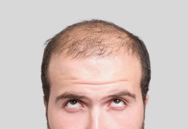 ����Ó�l��ô�k������Ó�l��ʲôԭ�������