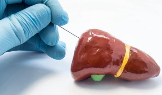 脂肪肝會帶來的危害 什么樣的人容易患上脂肪肝