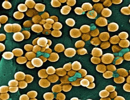 食品四大致病菌排行,肉毒桿菌會導致呼吸困難、沙門氏菌引起食物中毒