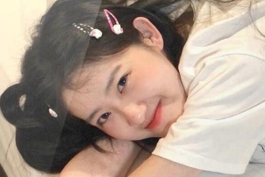 腋毛上有黃黃的附著物是狐臭嗎 腋毛上像蠟一樣的東西怎么去除