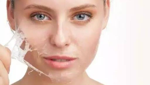 皮膚角質層薄適合刷酸嗎 刷酸角質層會變薄嗎