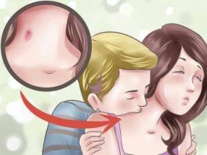 �N��ݮ��ʲô��˼ �N��ݮ�ļ���ԓ��ô�� �N��ݮ���ǺۈDƬ