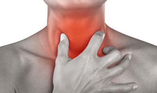 喉癌的早期癥狀 預防喉癌刻不容緩