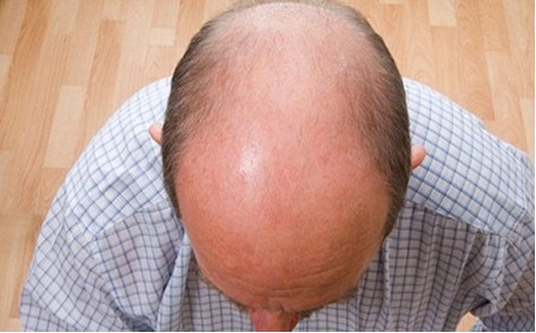 禿頂男人