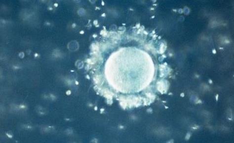 女人如何提高卵子質量