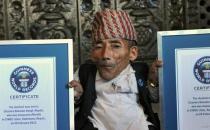 世界上最矮成人男子去世，享年75歲