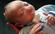 沒有鼻子的嬰兒，媽媽說他是完美的