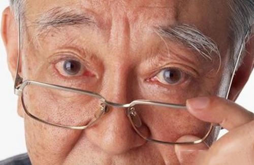 老花眼的典型癥狀有哪些
