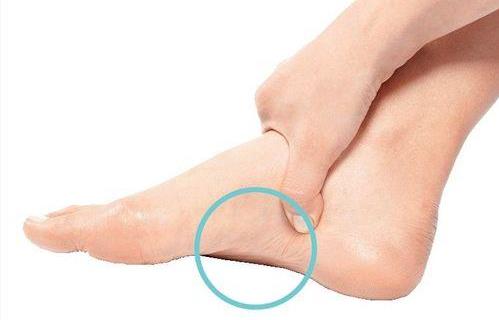 如何預防孩子得上扁平足