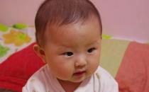 冬季養生 寶寶嘴唇干裂怎么辦