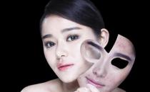 七個小竅門幫你戰勝痘痘