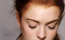 祛斑失敗的原因有哪些 如何應對