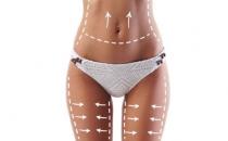 吸脂減肥有哪些風險？